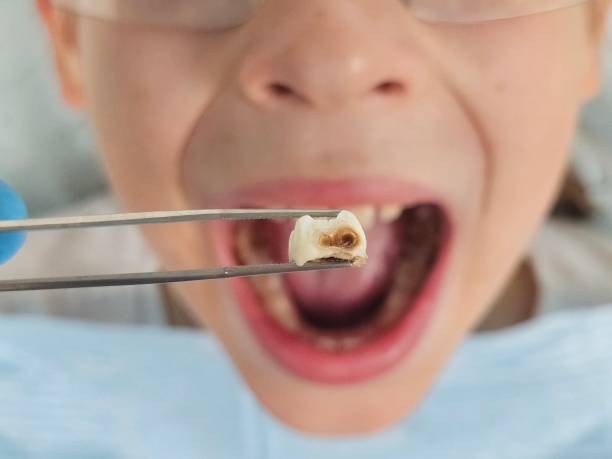 Best Pediatric Emergency Dentist in Tarkio, MO